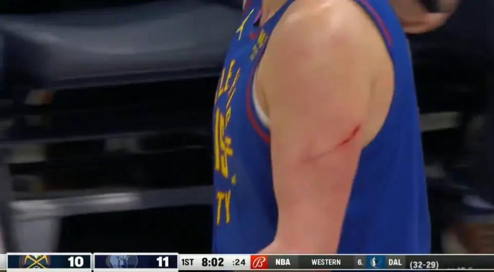 关于灰熊队队员受伤，球队备战备战增加难度的信息