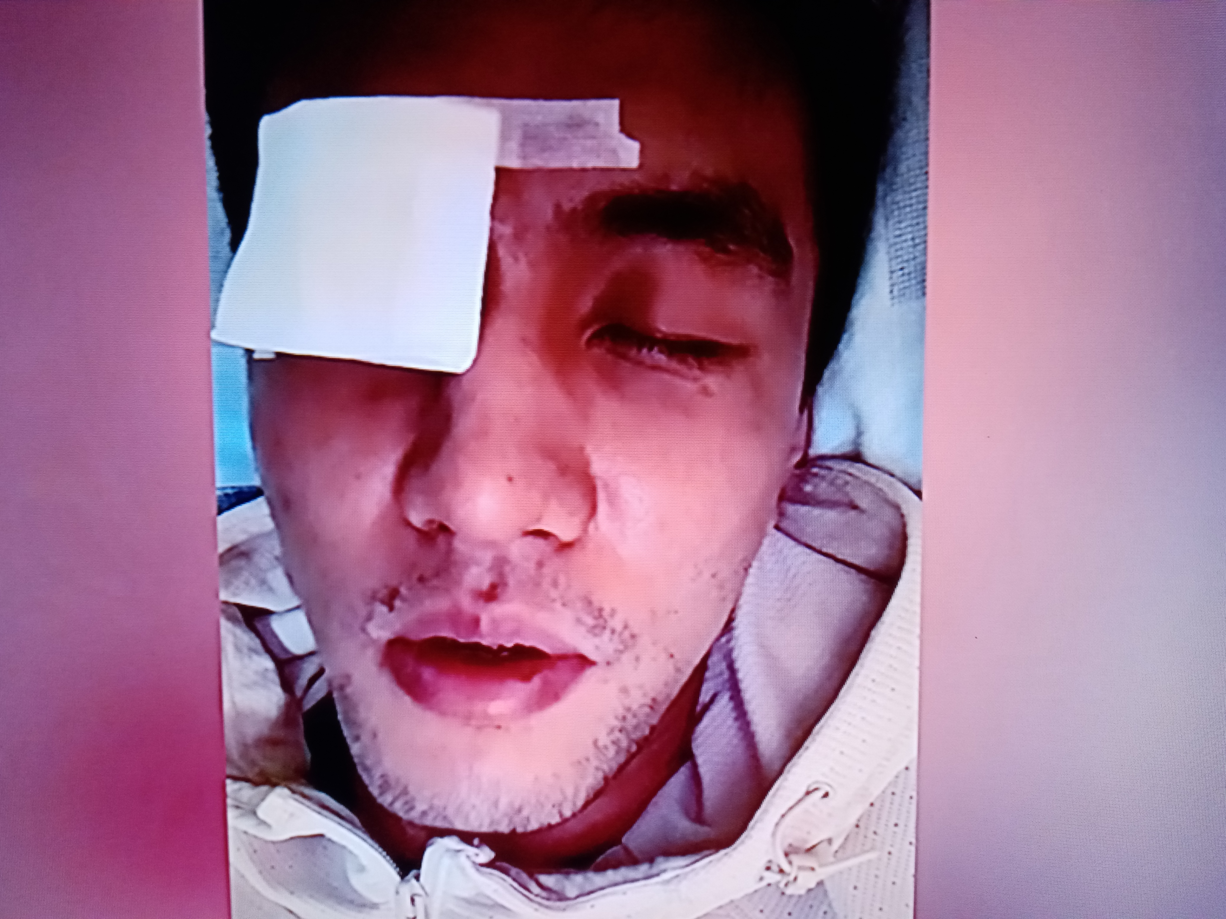 公牛队球员接受手术治疗伤病的简单介绍 公牛队球员接受手术治疗伤病的简单介绍